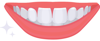 clear braces illustration