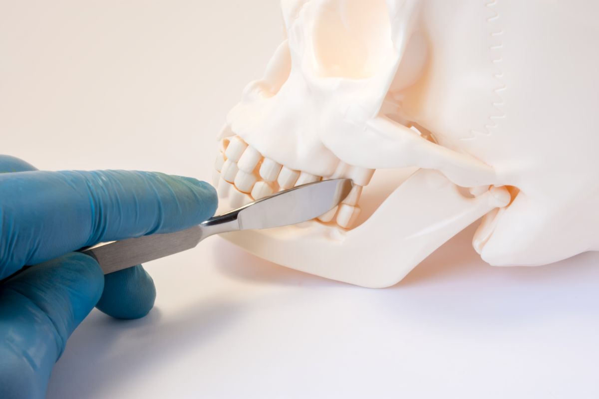 What Is Orthognathic Surgery