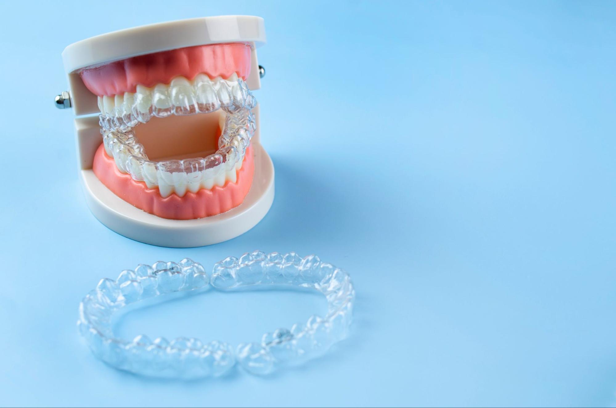 Learn how clear aligners work at Clauss Orthodontics