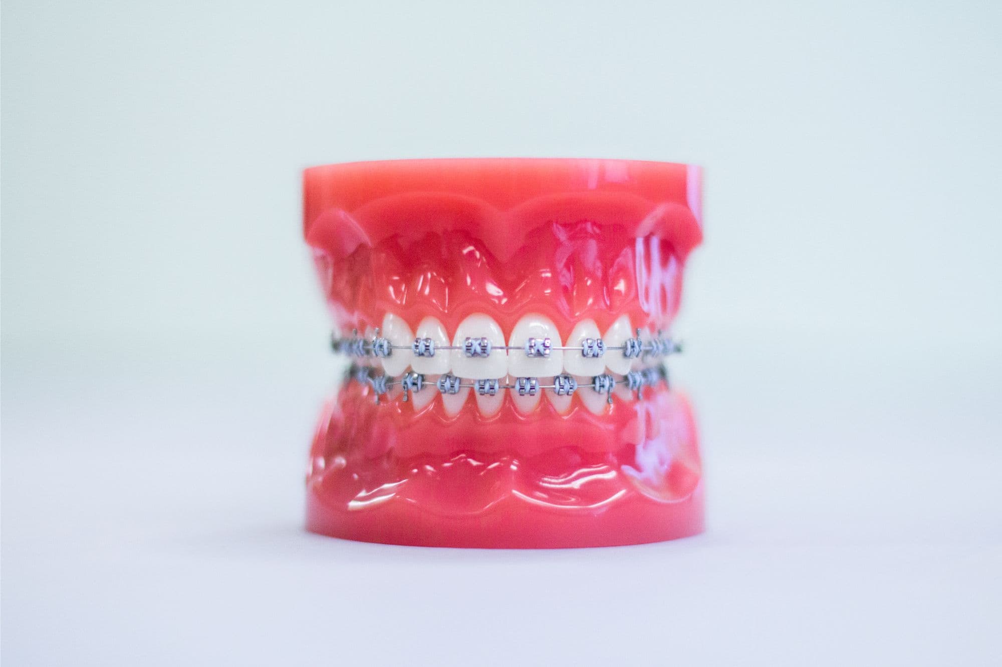 orthodontist southbury metal braces orthodontist southbury metal braces